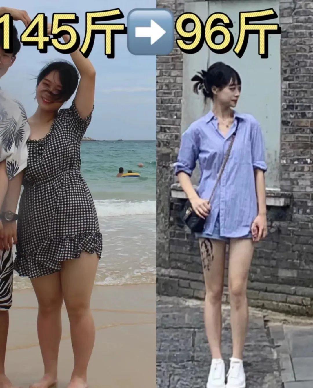 女子诈骗150万后整容换脸潜逃，惊天骗局揭秘！