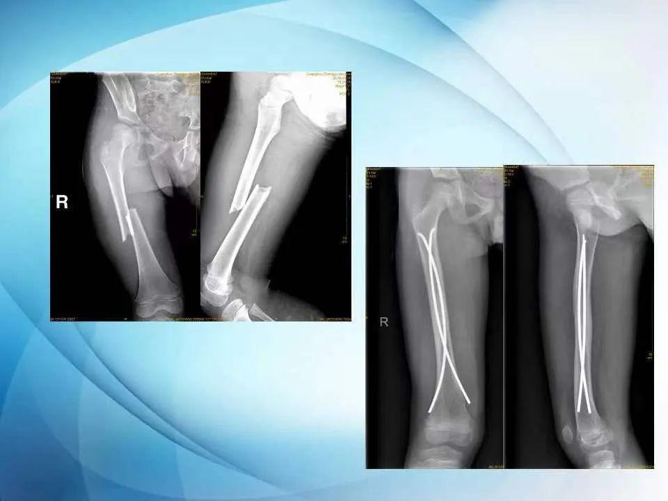 医生高超手法