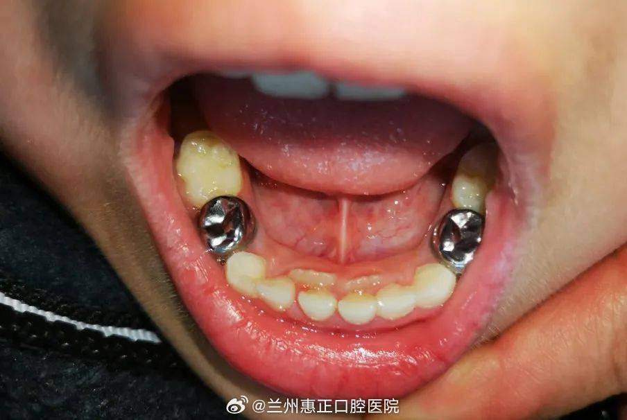 宝宝口腔健康呵护