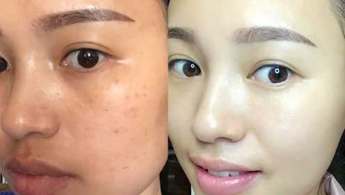 重塑白皙光彩肌肤