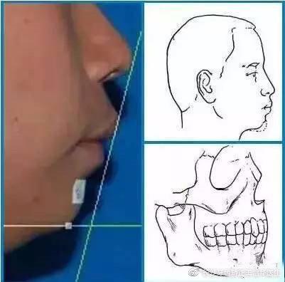 女明星的友情